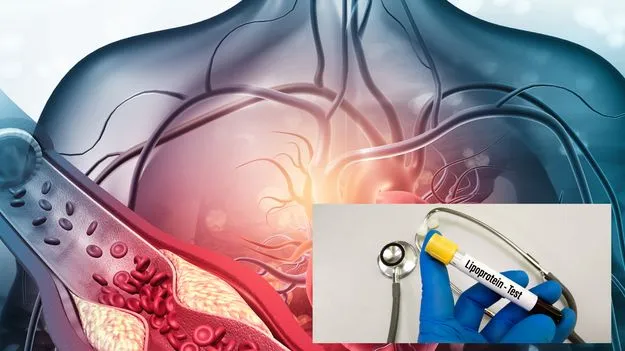 లైపోప్రొటీన్‌(ఎ).. సైలెంట్‌ కిల్లర్‌