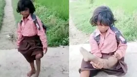 ఏడేళ్ల పాప.. ఒంటికాలితో గెంతుతూ బడికి! 