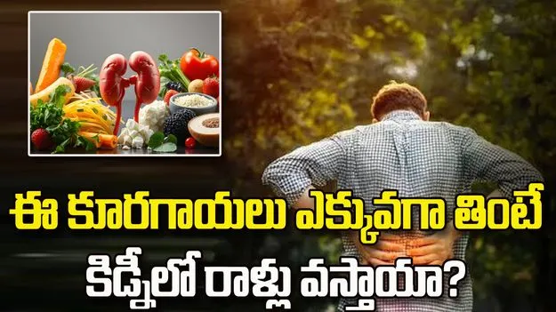 ఈ కూరగాయల్లో ఆక్సలేట్లు ఎక్కువ.. కిడ్నీలో రాళ్లున్నవారు జాగ్రత్త