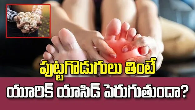 యూరిక్ యాసిడ్ ఉన్నవారు పుట్టగొడుగులు తినొచ్చా?