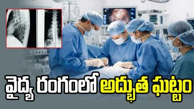 పక్షవాత బాధితుడికి వెన్నుపాము మార్పిడి.. చైనా, రష్యా వైద్యుల ఘనత..
