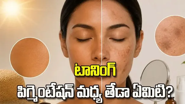 టానింగ్,  పిగ్మెంటేషన్ మధ్య తేడా ఏమిటి?