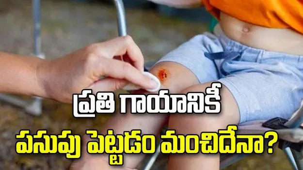 గాయాలకు పసుపు పెడుతున్నారా? అయితే ఈ విషయాలు తప్పక తెలుసుకోండి