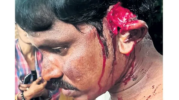 Crime: నిద్రపోతుండగా చెవి కోసేశారు