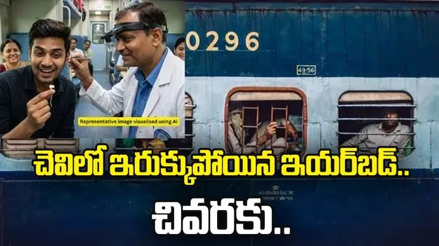 ప్రయాణికుడి చెవిలో ఇరుక్కుపోయిన ఇయర్‌బడ్ టిప్.. చివరకు.. 