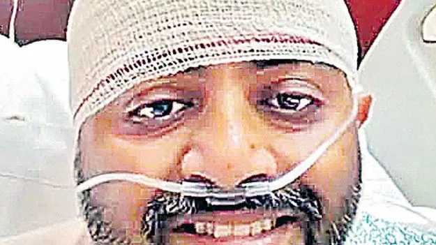 మచ్చార్‌ పుర్రెకు ఫ్రాక్చర్‌