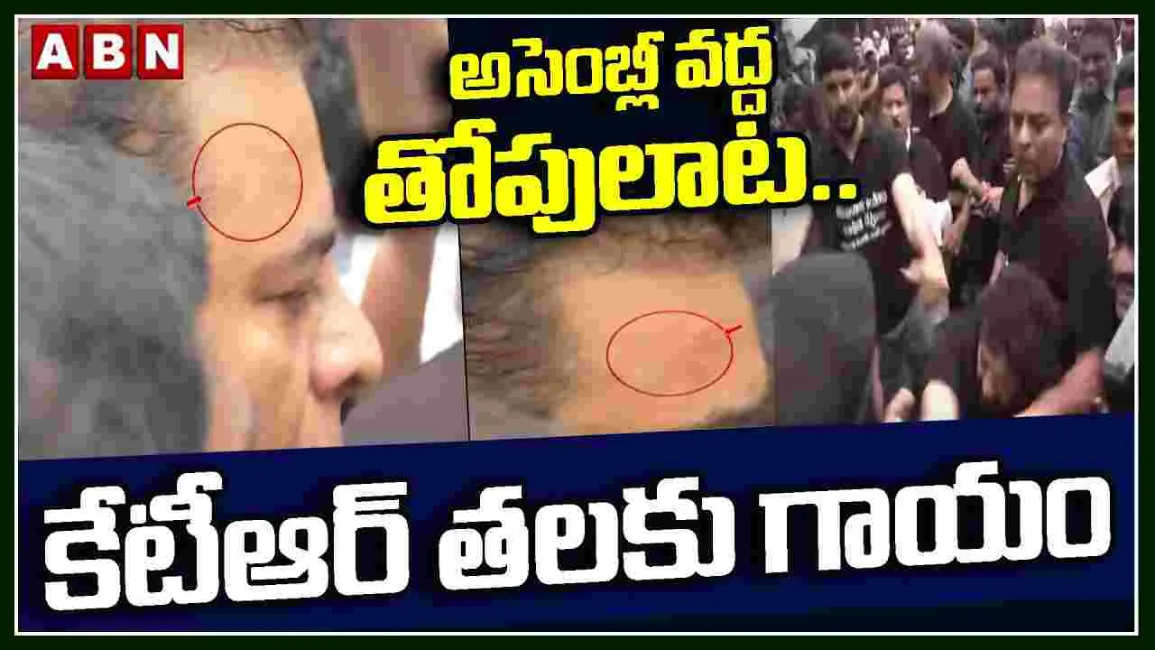 అసెంబ్లీ వద్ద తోపులాట.. కేటీఆర్ తలకు గాయం 