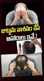 ఈ ఆహారాలు తింటే బట్టతల గ్యారెంటీ..! 